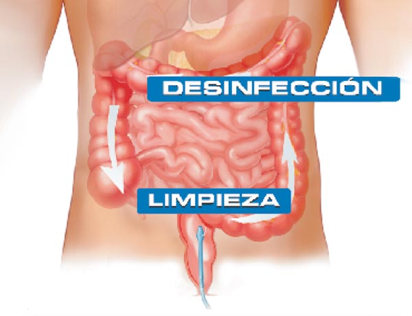 LavadoColonico Lavado Colónico